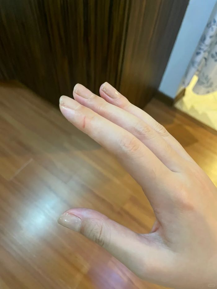 Hình troll đứt tay kinh dị hù dọa 100%