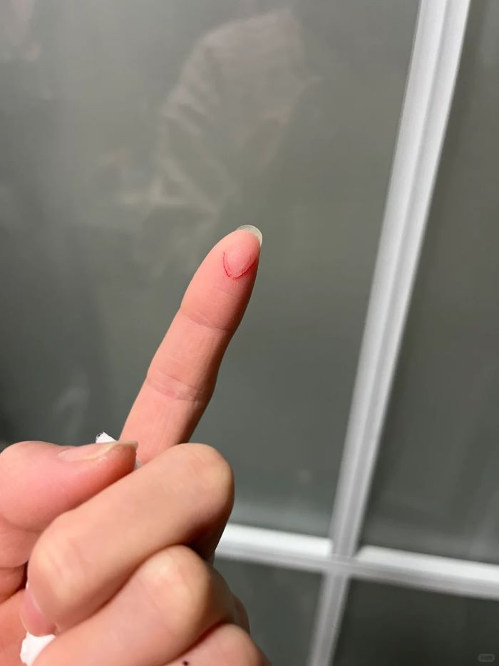 Hình ảnh đứt tay giả troll gây sốt