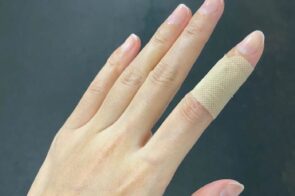 Tổng hợp 29+ ảnh đứt tay troll – Ai nhìn cũng giật mình!