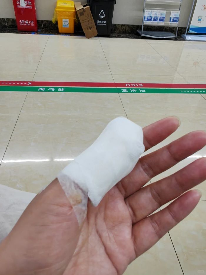 Ảnh đứt tay troll cực chân thực