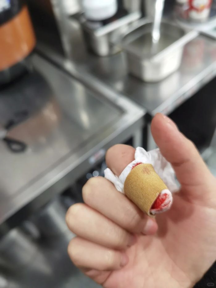 Ảnh đứt tay troll nhìn như thật siêu chân thực