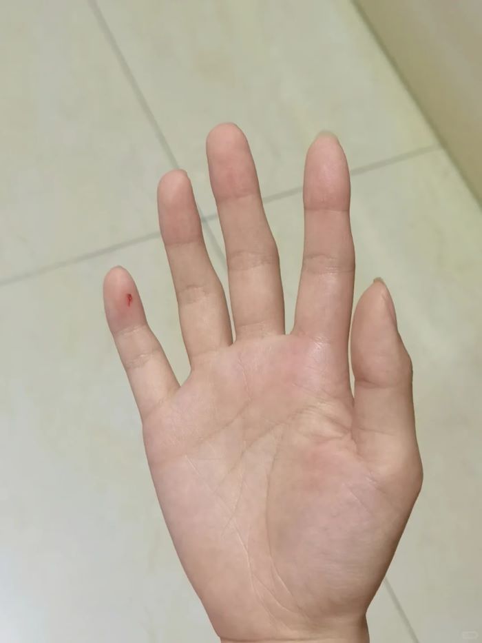 Ảnh đứt tay giả hù người thân