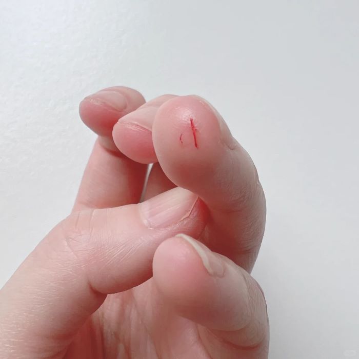 Ảnh đứt ngón tay troll bạn cực hài hước
