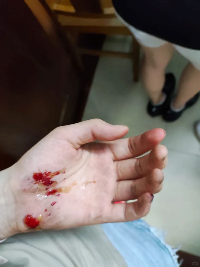 ảnh ngã xe 10