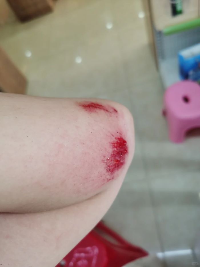 ảnh ngã xe 20