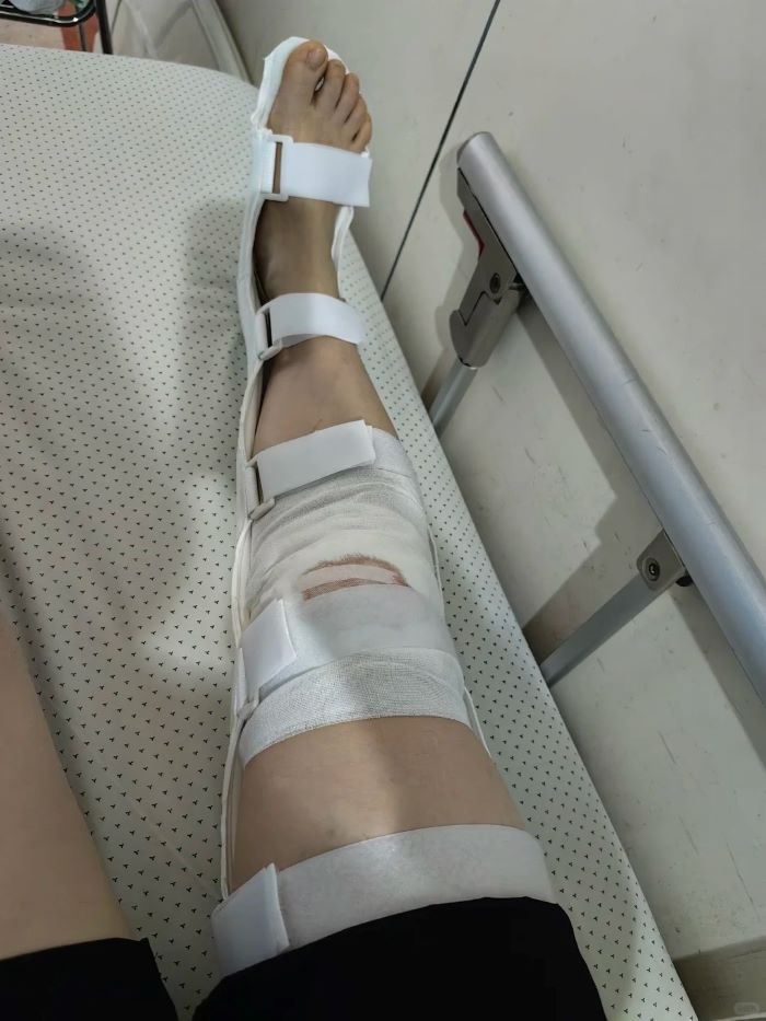 ảnh ngã xe 25